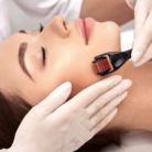 Derma Roller Acne Marks For Face