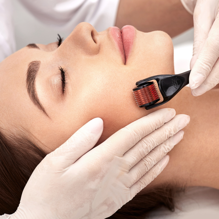 Derma Roller Acne Marks For Face