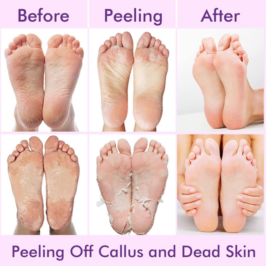 Foot-Peeling-Mask2-1693054104